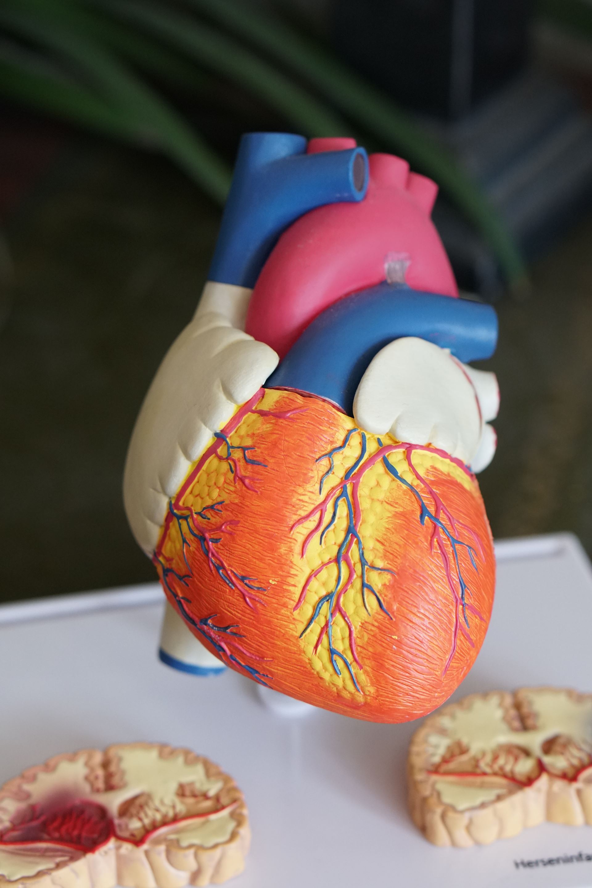 a model of a heart