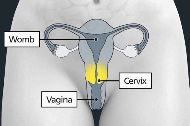 cervical diagram screening